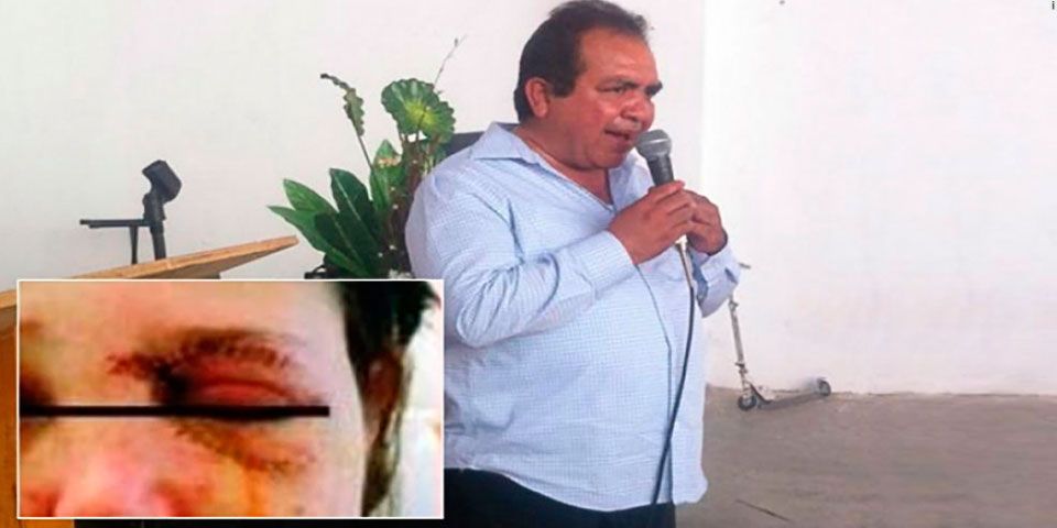 Regidor de Durango considera que es “normal” golpear a una mujer Regidor de Durango considera que es “normal” golpear a una mujer