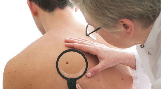 Cáncer de piel se ha incrementado 2.5% en México: Cofepris Cáncer de piel se ha incrementado 2.5% en México: Cofepris