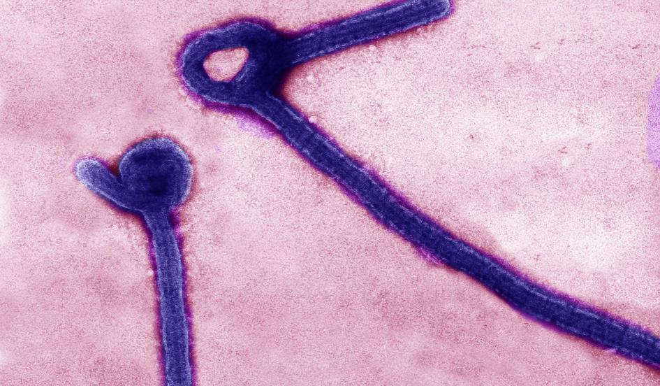 Posible caso de ébola en Sacramento Posible caso de ébola en Sacramento