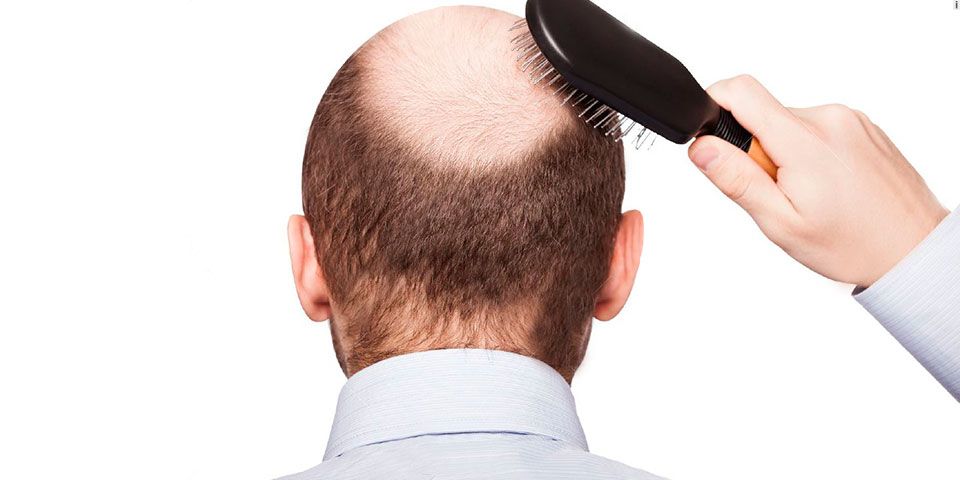 La clonación capilar será una realidad en los próximos años - fot29ene15-91