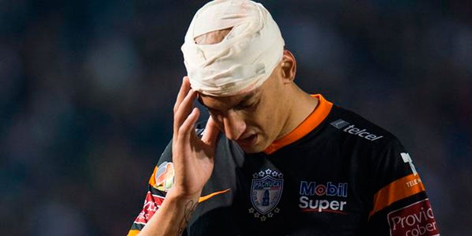 Nahuelpán sin daños graves tras golpe en la cabeza Nahuelpán sin daños graves tras golpe en la cabeza