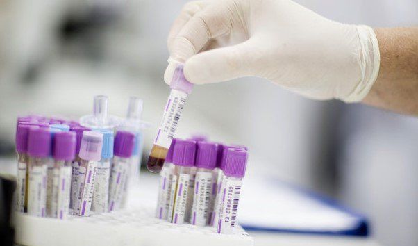 Siete millones de mexicanos padecen “enfermedades raras”