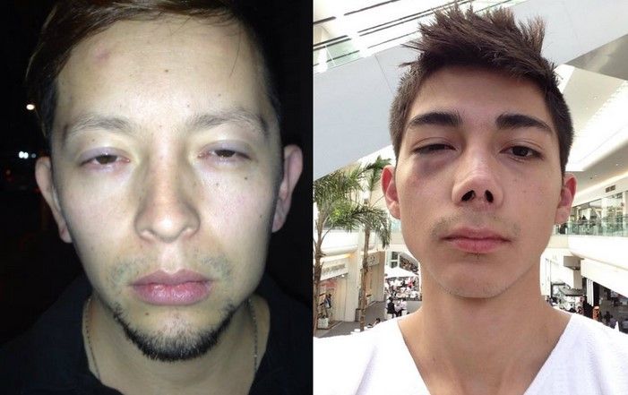 Precandidato del PT agrede a pareja homosexual