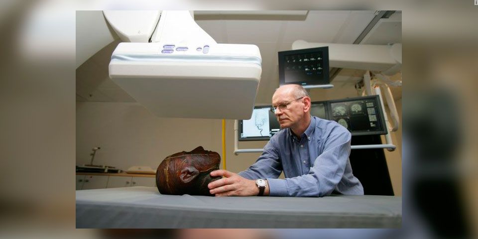 En 2017 podría realizarse el primer trasplante de cabeza