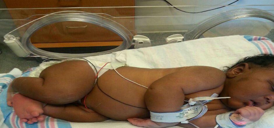 Nace bebé de 6 kilos en Florida Nace bebé de 6 kilos en Florida