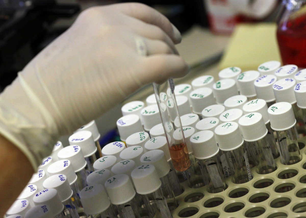 Descubren virus letal en Kansas Descubren virus letal en Kansas