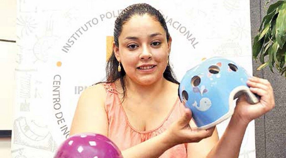 Estudiantes del IPN crean casco que corrige deformidades
