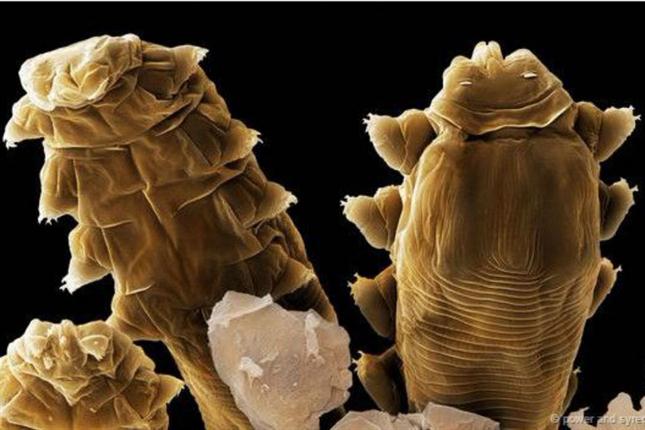 Ácaros darán pistas sobre la evolución humana Ácaros darán pistas sobre la evolución humana