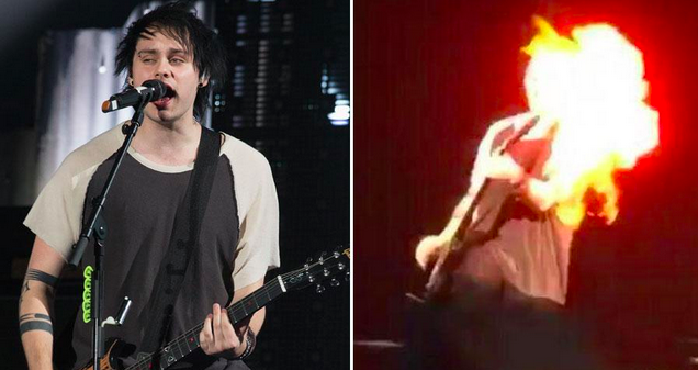 Guitarrista se quema la cara en el escenario Guitarrista se quema la cara en el escenario