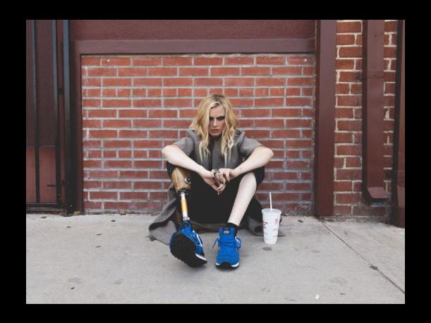 Modelo pierde pierna por infección por tampón