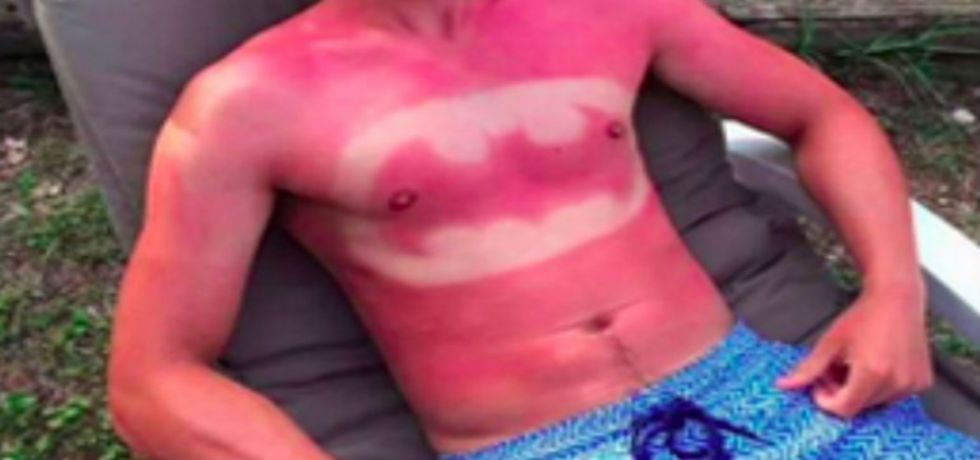 Surge peligrosa moda de tatuarse en el verano