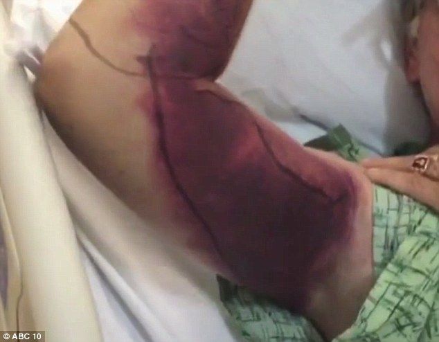 Selfie cuesta más de 2 mdp y casi la vida a un hombre