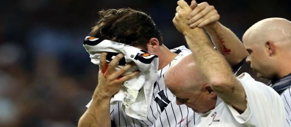 Pitcher de Yankees sale por fuerte pelotazo en la cabeza