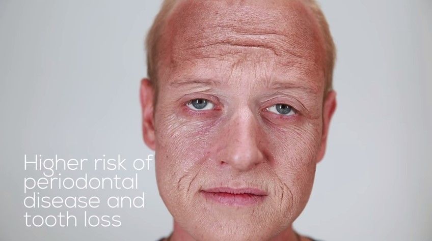 Así afecta el tabaco al físico Así afecta el tabaco al físico