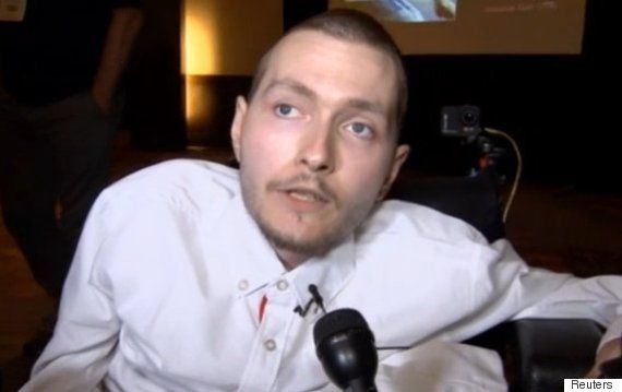 Primer trasplante de cabeza podría lograrse en 2017 Primer trasplante de cabeza podría lograrse en 2017