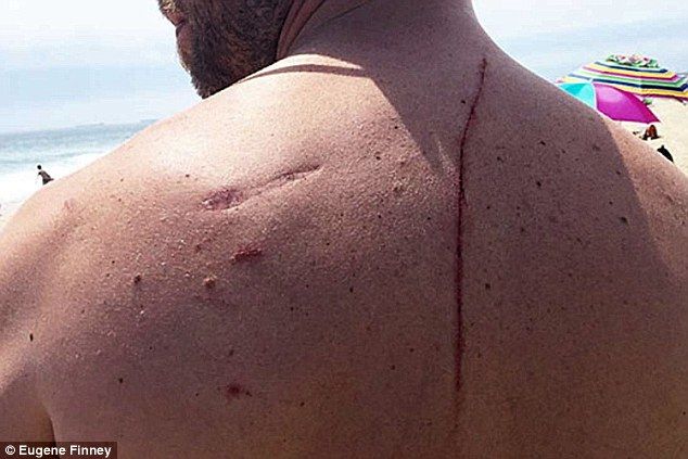 Ataque de tiburón salva a hombre - fenney1