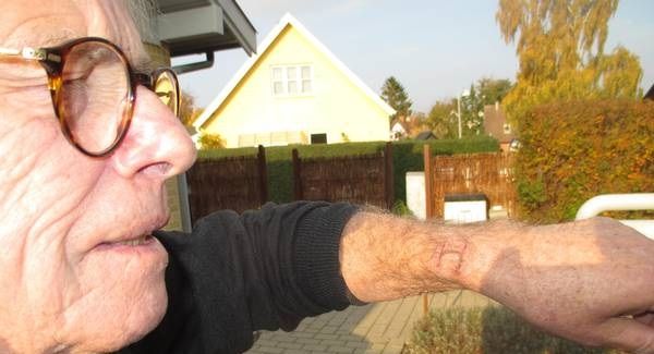 Apple Watch provoca severas quemaduras a usuario