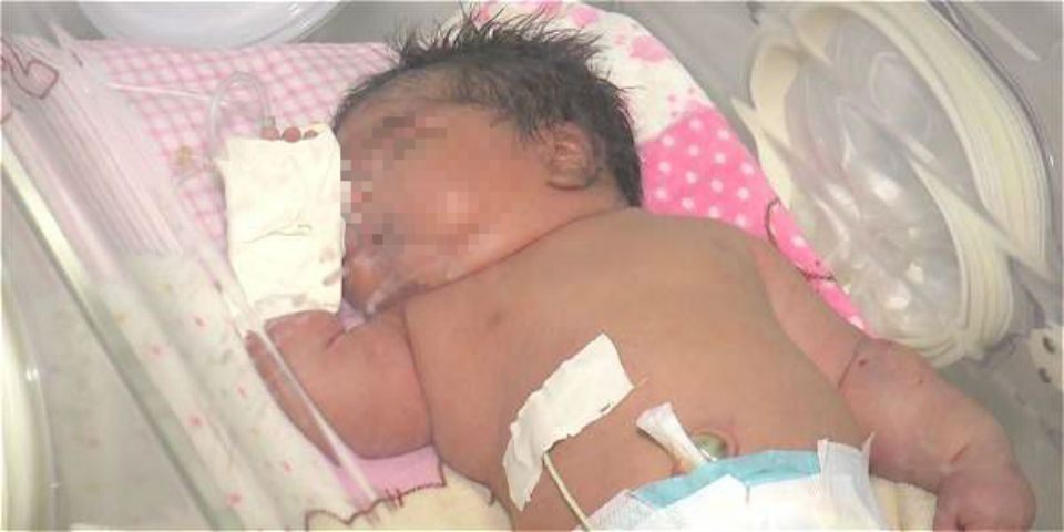Nace en Colombia bebé de 6 kilos