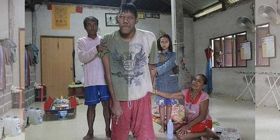 Muere el hombre más alto del mundo Muere el hombre más alto del mundo