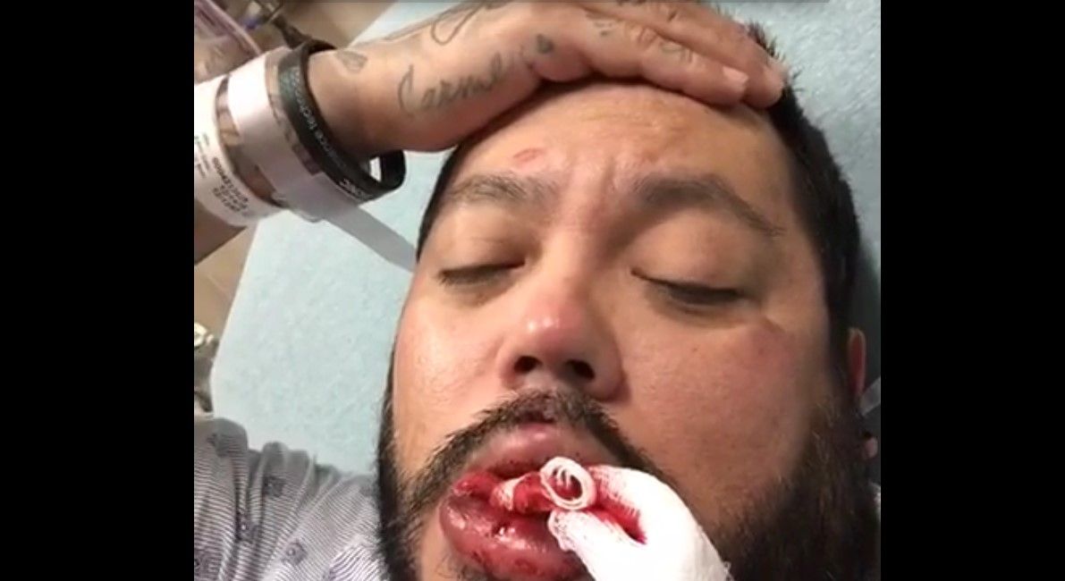 Video: el accidente de A.B. Quintanilla por abuso del alcohol