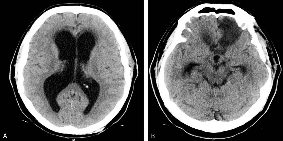 Implantan experimento médico ilegal a 194 mexicanos