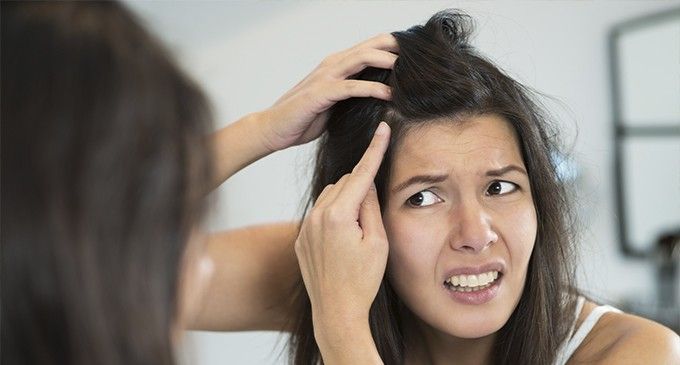 Cinco remedios caseros para combatir la caspa - capa-2