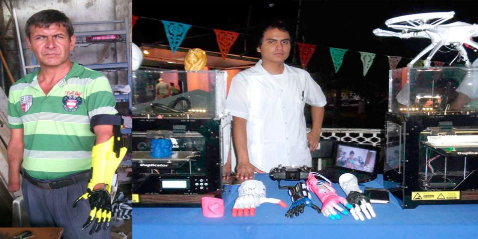Mexicano crea prótesis de bajo costo