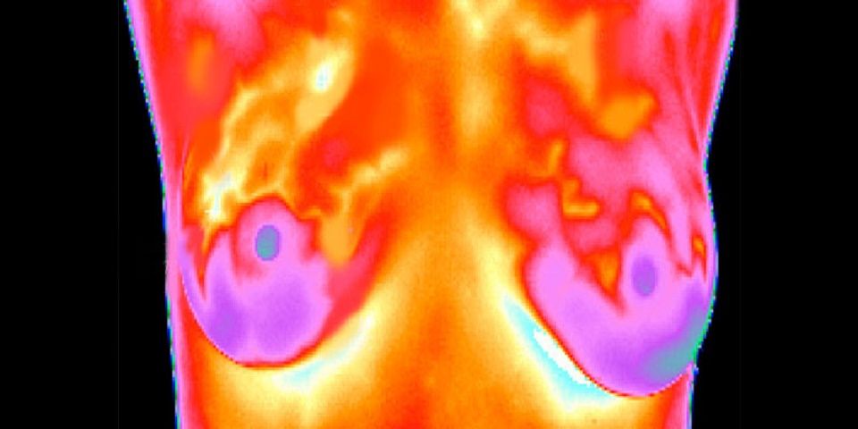 Termografía para detección de cáncer de mama