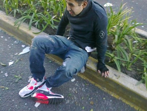 Explosión en la colonia Del Valle deja siete lesionados - internet