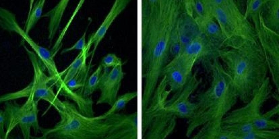 Estudio en ratones podría revertir envejecimiento en humanos - Celulas-Senescentes