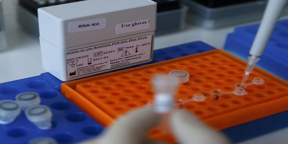 Detectan el zika en saliva y orina