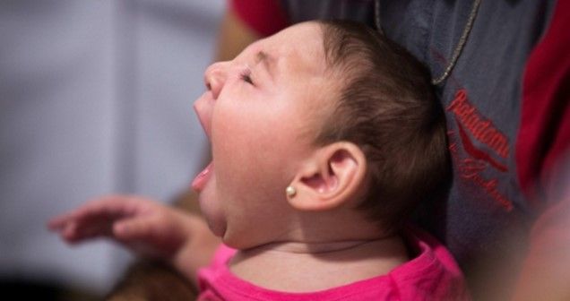 OMS recomienda abstinencia para evitar virus del Zika - microcefalia1