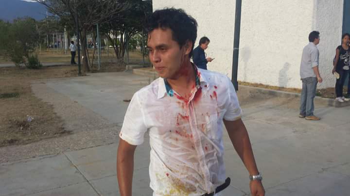 Zafarrancho en la UABJO deja 20 de heridos - 20160308170535