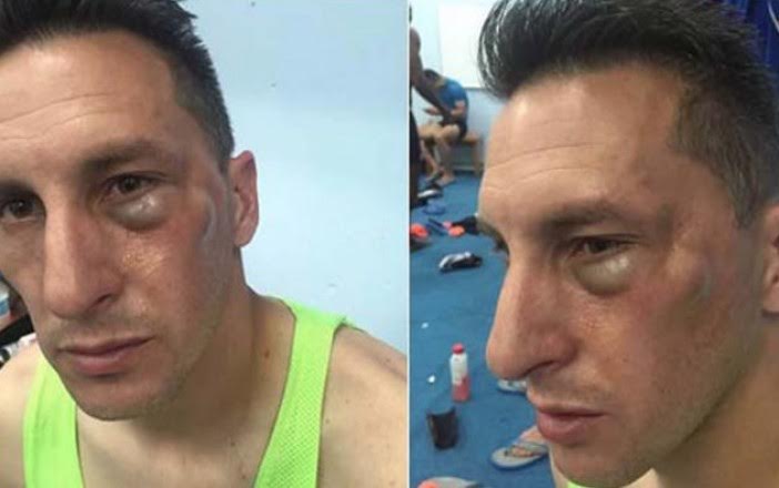 ‘Chaco’ Giménez caricaturiza su fractura en Twitter