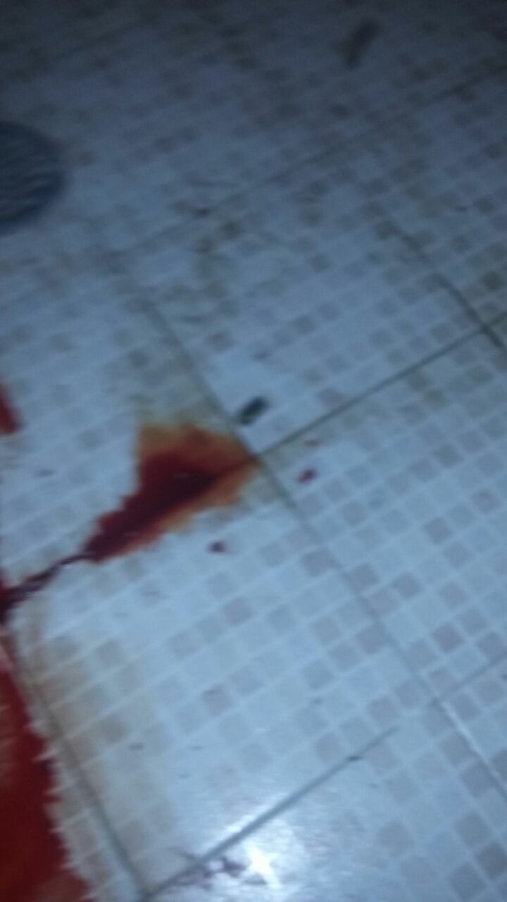 Ataque a Comisión de Agua de Acapulco deja un muerto y un herido - ataque-acapulco-2