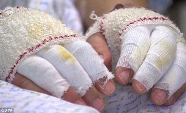 'Se sintió como el fin del mundo': víctima de atentado en Bruselas - manos-hermana-fanny-clain