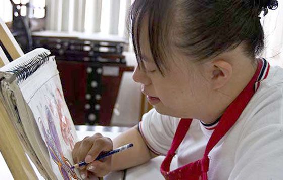 EPN aboga por personas con Síndrome de Down - sindrome-de-down2