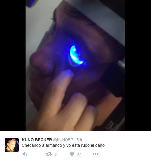 Pierde Kuno Becker visibilidad en un ojo - @KunoBecker