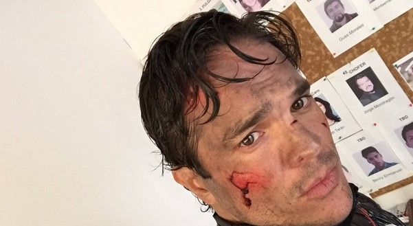 Pierde Kuno Becker visibilidad en un ojo