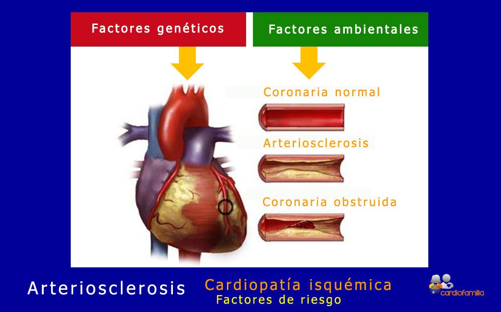 Personas entre 30 y 45 años, más susceptibles a padecer un infarto - cardio-familia