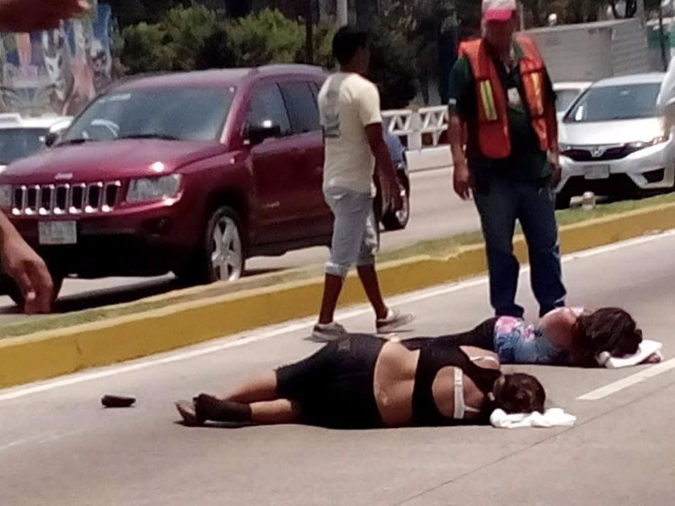 Choque de motos deja cuatro lesionados en Acapulco - lesionados-acapulco