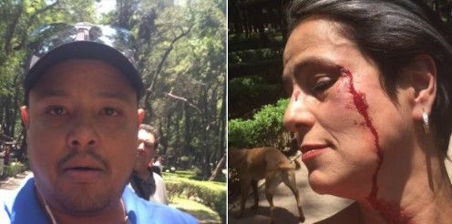 Tienen localizado a agresor de actriz en el Parque México