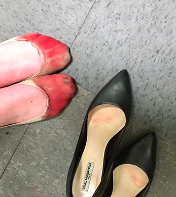 Despiden a mujer por no usar zapatos de tacón - tacones-sangre