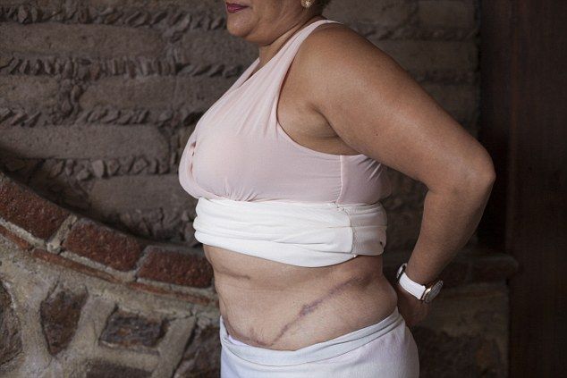 Supuesta cirujana plástica desfiguró a víctimas en Guanajuato - carnicera-3