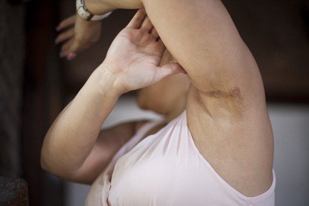 Supuesta cirujana plástica desfiguró a víctimas en Guanajuato - carnicera-4