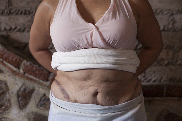 Supuesta cirujana plástica desfiguró a víctimas en Guanajuato - carnicera-5