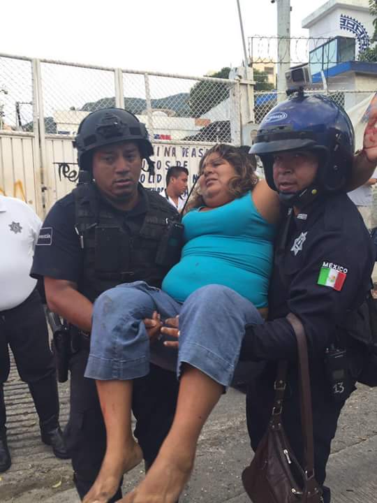 Choque de camiones en Acapulco deja 41 heridos - e0c3c3a5-4ad3-48c1-b2d7-a5120d415500