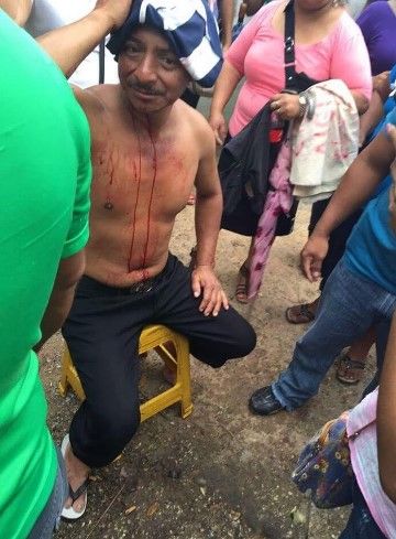 Al menos 25 heridos por enfrentamiento en Tabasco - enfrentamiento-tamulte-internet4