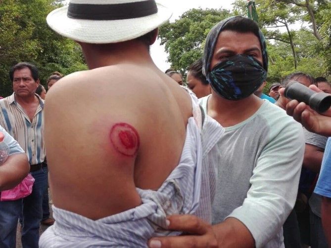 Al menos 25 heridos por enfrentamiento en Tabasco - enfrentamiento-tamulte-internet5