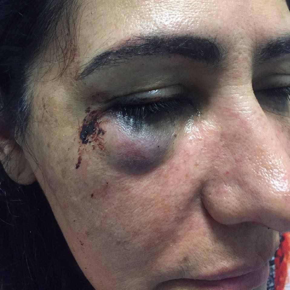 Esposa de exdiputado denuncia violación en autobús de ETN - etn-4